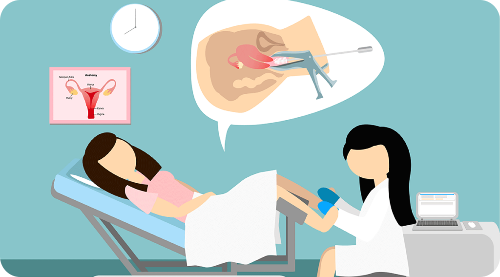 A Pap smear, also called a Pap test, is a procedure that collects cells from the cervix for testing and is usually done during a pelvic exam, using a speculum to hold the vaginal walls apart and a brush or spatula to gently scrape cells from the cervix